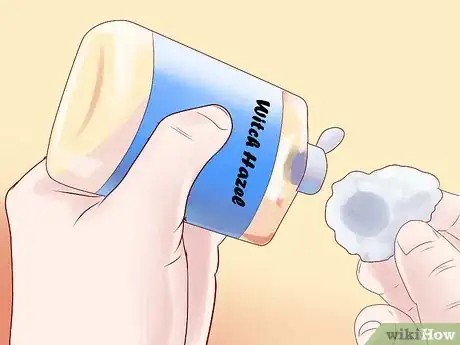 Image titled Spot the Symptoms of Hemorrhoids Step 11