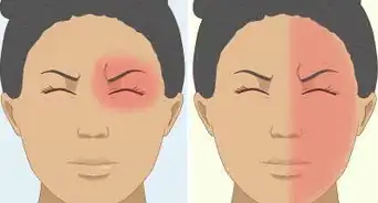 Get Rid of a Headache