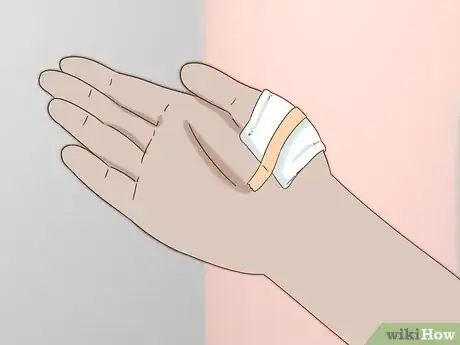 Image titled Heal Cuts Step 7