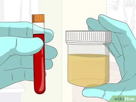 Image titled Diagnose Arthritis Step 9