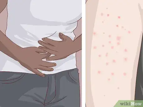 Image titled Use Oral Immunotherapy Step 8