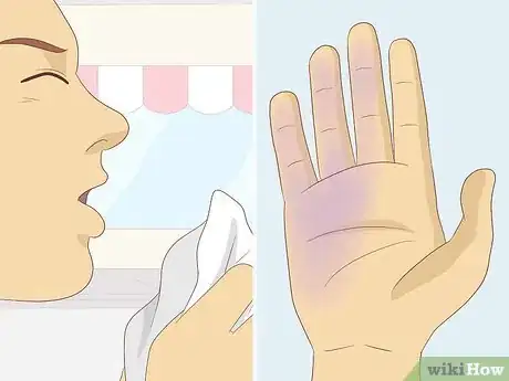 Image titled Differentiate Between the Flu and Coronavirus Step 7