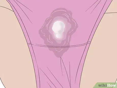 Image titled Prevent Trichomoniasis Step 5