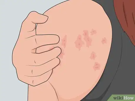 Image titled Prevent Sleeping Sickness Step 7