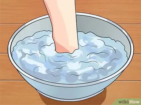 Image titled Remove a Dead Toenail Step 6