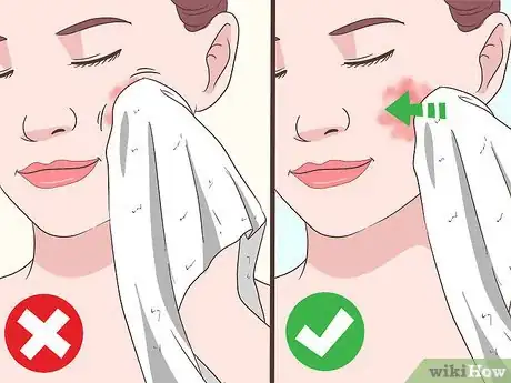 Image titled Heal Red Skin Step 9