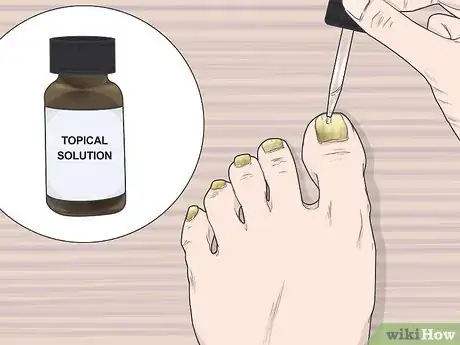 Image titled Do a Nail Treatment Step 3