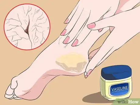 Image titled Relieve Skin Irritated by Face Wash Step 5