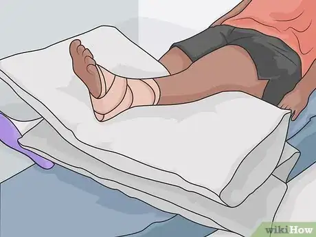 Image titled Treat a Foot Wound Step 10