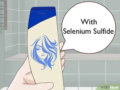 Image titled Get Rid of Dandruff at Home Step 2