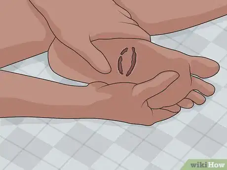 Image titled Treat a Foot Wound Step 14