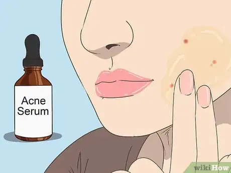 Image titled Deal with Post Birth Control Syndrome Step 6