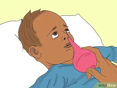 Image titled Help a Baby with a Runny Nose Step 2