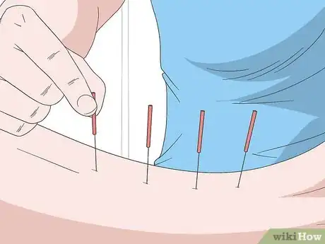 Image titled Relieve Herniated Disc Pain Step 12