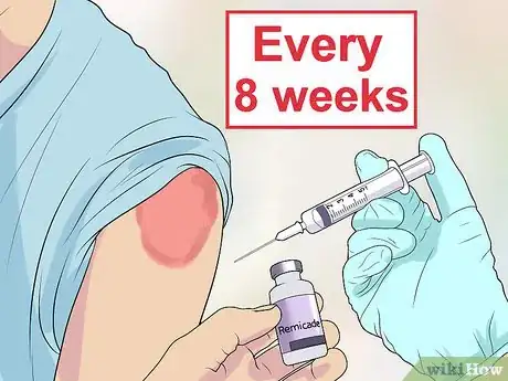 Image titled Treat Psoriasis with Biologics Step 4