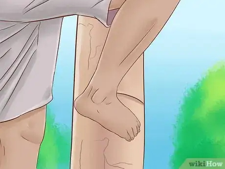 Image titled Climb a Tree With No Branches Step 4