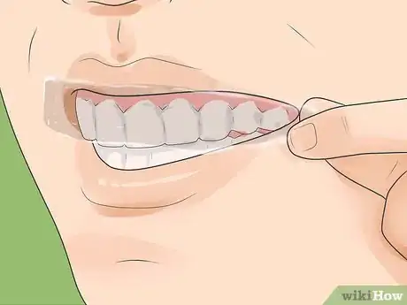 Image titled Get Low Cost Tooth Whitening Step 1