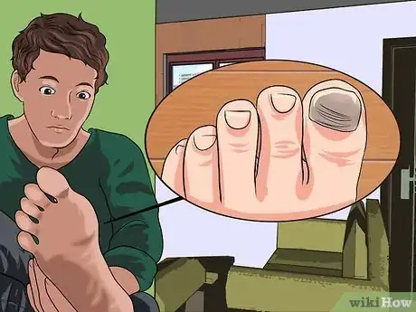 Image titled Remove a Dead Toenail Step 9