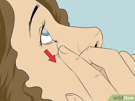 Image titled Insert Eyedrops if You Are Visually Impaired Step 10