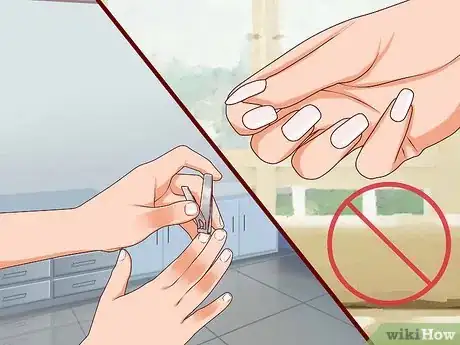 Image titled Relieve Discomfort Caused by Eczema Step 6