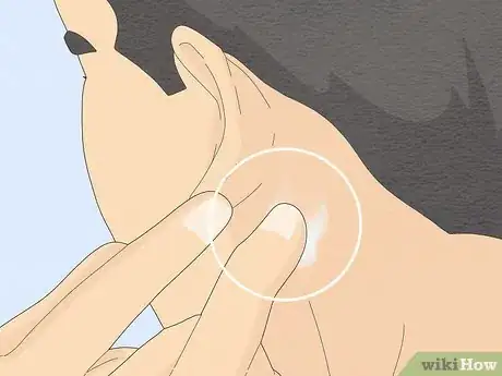 Image titled Patch Test Skin Step 13