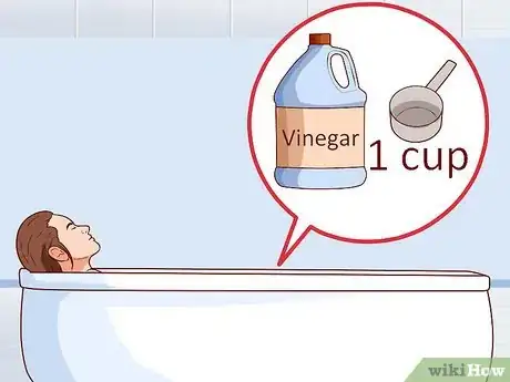 Image titled Relieve Discomfort Caused by Eczema Step 9