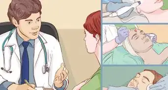 Get Clear Skin Fast and Naturally