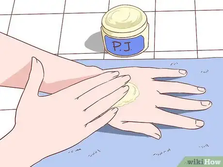 Image titled Handle an Eczema Flare Up Step 25