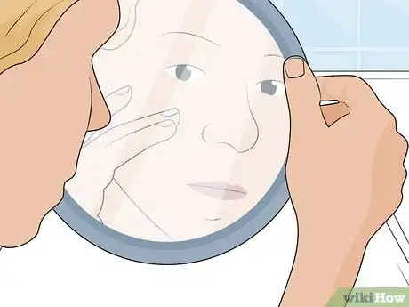 Image titled Prepare for Botox Side Effects Step 01