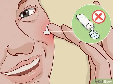 Image titled Reduce Acne Pain Step 6
