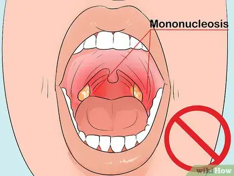 Image titled Decrease Your Risk of Developing MS (Multiple Sclerosis) Step 6