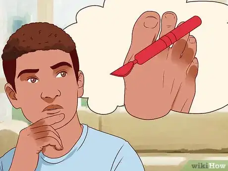 Image titled Relieve Bunions Step 11