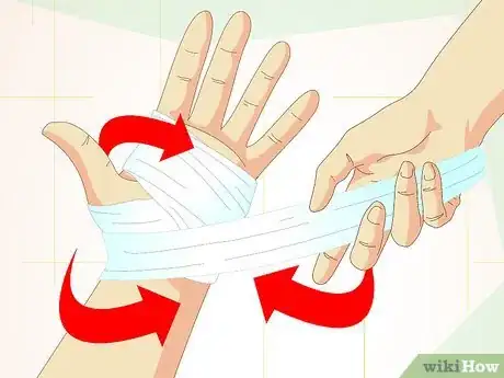 Image titled Care for Superficial Wounds Step 20