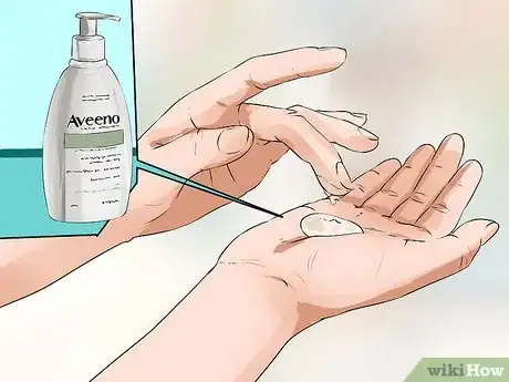 Image titled Reduce Eczema Itching Step 1