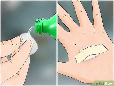 Image titled Reduce the Pain of Gnat Bites Step 2