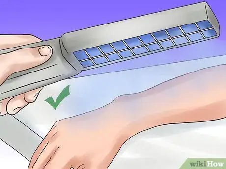 Image titled Care for Itchy and Irritated Skin Step 14