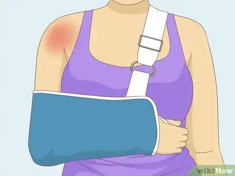 Image titled Identify a Rotator Cuff Injury Step 11