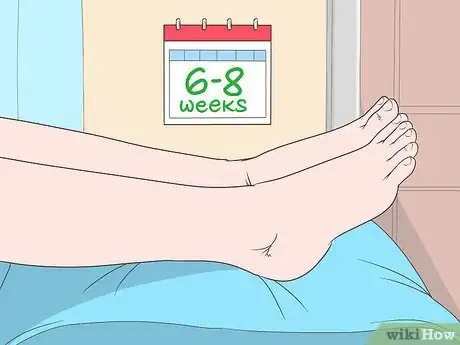 Image titled Return to Running After a Stress Fracture Step 5