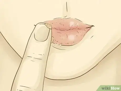 Image titled Get Angelina Jolie's Lips Step 1