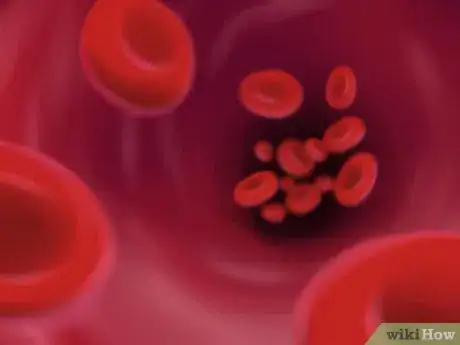 Image titled Determine Cardiac Output Step 13