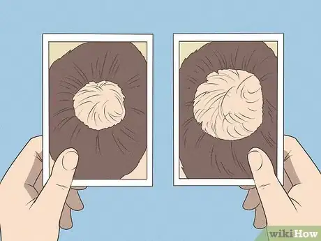 Image titled Know if You Have Male Pattern Baldness Step 6