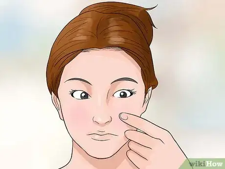 Image titled Hide Pimples Step 14