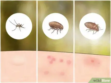Image titled Identify Insect Bites Step 2