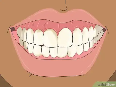 Image titled Prevent Tooth Enamel Erosion Step 8