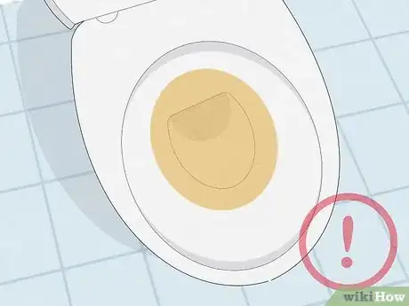 Image titled Recognize Hepatitis A Symptoms Step 4