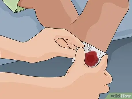 Image titled Treat a Foot Wound Step 03