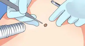 Prevent Skin Cancer for Kids