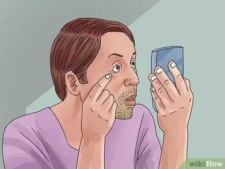 Image titled Keep Your Eyes Healthy when Using Decorative Lenses Step 6