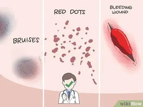 Image titled Overcome Platelet Deficiency Step 1