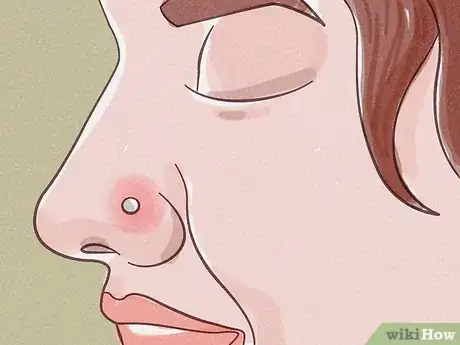 Image titled Treat an Infected Nose Piercing Step 1